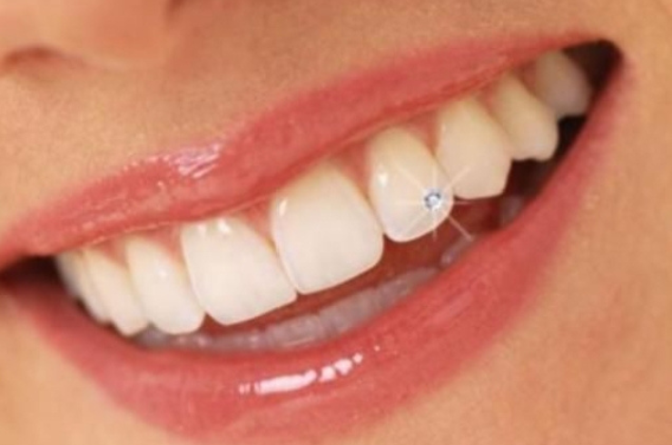 Tooth Jewellery
